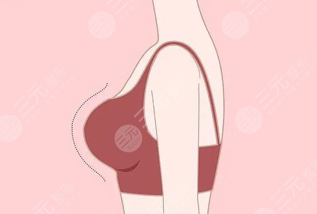 假體隆胸的材料什么牌子好？假體品牌各優(yōu)勢(shì)缺點(diǎn)詳細(xì)介紹~來(lái)選你喜歡的吧~