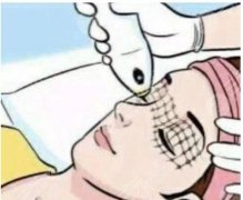 電波拉皮手術(shù)價(jià)錢影響因素分析，手術(shù)后會(huì)留疤嗎?