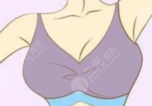 注射材料的選擇