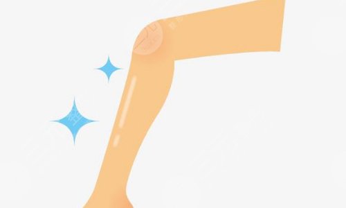 怎樣讓小腿變細(xì)？4種日常簡單方法以及吸脂介紹！