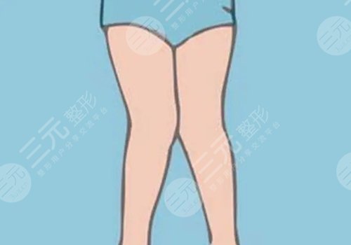 怎樣讓小腿變細(xì)?