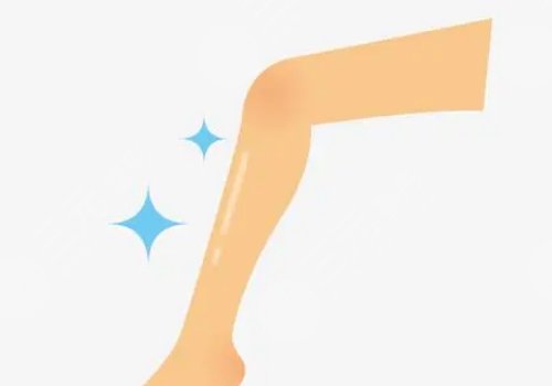 怎樣讓小腿變細(xì)?