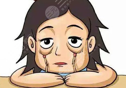 自體脂肪填充下眼瞼凹陷有哪些優(yōu)勢(shì)和弊端?