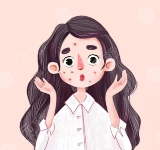 復(fù)合彩光去痘幾次有？復(fù)合彩光去痘的原理和果解析，網(wǎng)友打卡后反饋~