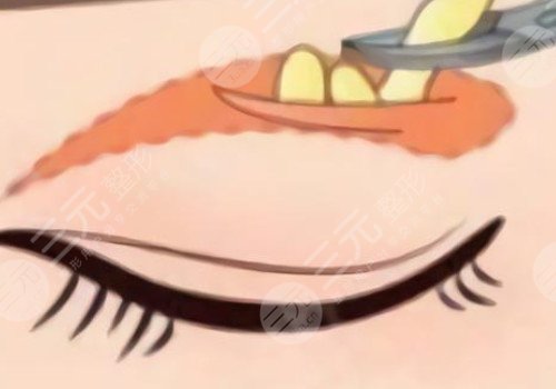 山大一院整形科哪個醫(yī)生技術(shù)好?