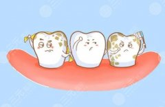 牙齒激光美白有用嗎？激光牙齒美白需要做幾次？術(shù)前準(zhǔn)備工作有哪些？