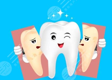 牙齒美白