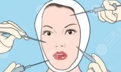 注射除皺的玻尿酸品牌有幾種？玻尿酸的作用有哪些？