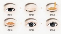 韓式三點(diǎn)雙眼皮恢復(fù)期需要多久？做埋線雙眼皮過(guò)程介紹！