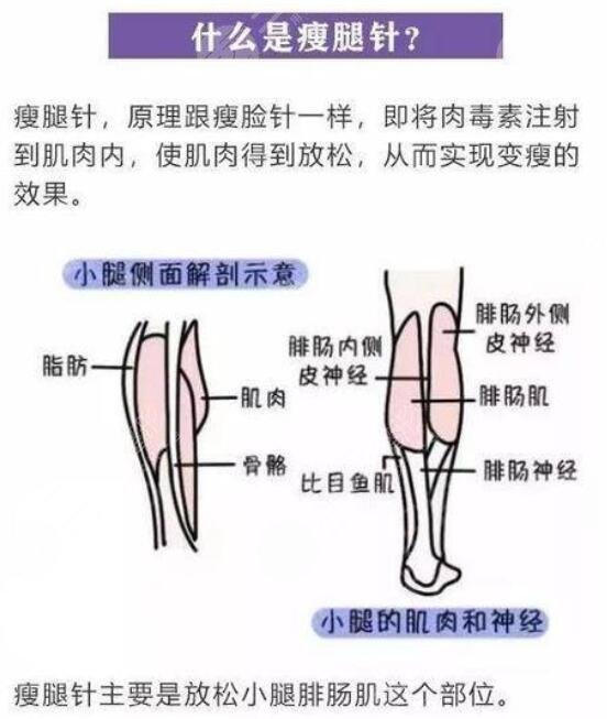 肌肉小腿怎么瘦成筷子腿肚子？