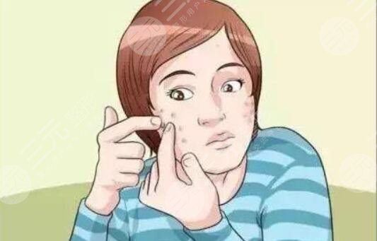 祛痘印的有方法有哪些？小妙法哪種更有果？從專業(yè)角度幫你解析~