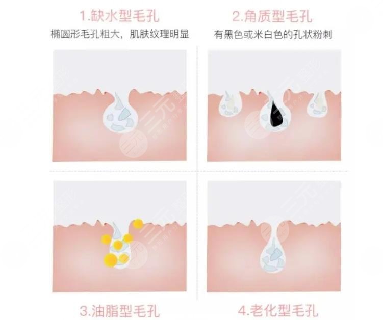 臉上毛孔大用什么護膚品比較好?