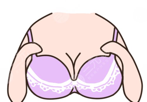 隆胸假體可以放一輩子嗎?