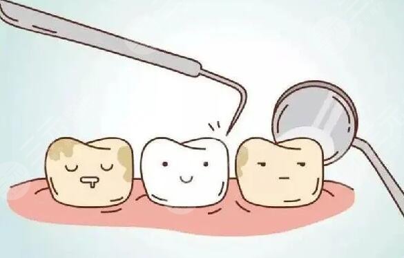 beyond冷光牙齒美白價(jià)格