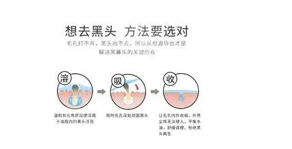 黑頭導(dǎo)出液真的有用嗎?