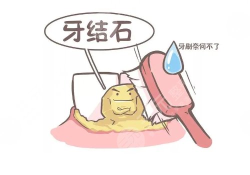 超聲波潔牙可靠嗎？