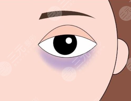 　　吃什么緩解黑眼圈果好又快速?黑眼圈可以說是我們的災難，稍微不注意黑眼圈就悄悄的冒了出來，即便擁有一張白皙靚麗的臉龐也忍受不了黑眼圈的出現(xiàn)，黑黑的黑眼圈一旦出現(xiàn)在臉上，就會讓我們看起來沒有精神，整個人焉了吧唧的。為了解決免不黑眼圈的問題，大家各種各樣的方法都是使用，目前使用的比較多的是使用各種各樣的眼霜，或者是通過醫(yī)美整形的方式來改良，又或者是通過飲食的改變來改良黑眼圈的問題，那么吃什么緩解黑眼圈?現(xiàn)在就和小編一起來認真的做一下功課吧!  　　一、黑眼圈是怎么出現(xiàn)的?  　　黑眼圈出現(xiàn)的原因有很多種，比較常見的一種是長時間的熬夜，導致眼部疲勞血液流通不暢，出現(xiàn)了紫紅色或者是青色的黑眼圈。還有一種是色素性黑眼圈，出現(xiàn)這種情況的原因有很多中，不單單是因為熬夜導致的，還有一些外界因素的印象，主要指因為長時間在陽光下暴曬，過多的藥物攝入，做了一些眼部手術等等，以及買了一些不適合自己的化妝品，引發(fā)了眼周蕁麻疹反映，都會導致眼周出現(xiàn)色素沉淀，對于這種色素性黑眼圈，主要是叫撒后這些黑色的細胞，減少黑色色素。  　　二、吃什么緩解黑眼圈果好又快速?  　　既然有黑眼圈的出現(xiàn)，就要積極的找到一個有的緩解方式，目前就有很多人說可以通過食物來改良黑眼圈的問題。那么具體吃哪些東西比較有果了?  　　1、攝入高蛋白的食物，高蛋白的食物有很多種，主要是牛奶，雞蛋以及各種肉類，積極增加自己的蛋白質攝入，可以有的緩解黑眼圈的形成，但是對高蛋白食物過敏的小伙伴，不建議使用這一種方法，大家可以通過其他的方式來改良自己黑眼圈的問題。  　　2、可以嘗試多吃一些動物的肝臟等食物，這些食物內部含有為豐富的維生素a，這個維生素可以很好的為我們眼周和眼球提供必需的物質，促進眼周的血液循環(huán)，幫助緩解黑眼圈。同時吃各種各樣有營養(yǎng)的食物來改良黑圈，也是一個比較好的選擇，大家可以根據(jù)自身的條件來制定一個比較不錯的食譜。  　　三、醫(yī)美整形手術改良黑眼圈  　　除了通過吃東西來改良黑眼圈以外，還有一種可實施比較有的方法，那就是通過醫(yī)美整形的方式來改良黑眼圈。目前針對黑眼圈的醫(yī)美整形項目也有幾個，小編整理了一些作用果不錯的幾個項目，現(xiàn)在就分享給大家吧!  　　1、激光緩解黑眼圈  　　激光緩解黑眼圈是一個比較常見的醫(yī)美整形項目，也是當下行之有的一種技術手段，他的操作難度不高，主要是通過激光的遠紅外長脈沖激光，作用在眼周的皮膚上，慢慢的滲透到皮膚深層，讓激光產生的爆破光熱能量將這些黑色素打散，改良皮膚的生成代謝，促進膠原代表的生成，在有去除黑眼圈的同時，也能樣眼周的皮膚更將光澤有彈性。這種激光緩解黑眼圈的方式一般適用于是色素性黑眼圈。  　　2、注射緩解黑眼圈  　　如果是結構性的黑眼圈，一般采用玻尿酸或者是脂肪來進行局部的注射填充來改良，這種黑眼圈一般是出現(xiàn)在家族遺傳病史上，隨著年紀的增加，到了十五六歲的時候就會出現(xiàn)結構性的黑眼圈，這時候就可以采取局部注射緩解大，可以很好的減少這種情況的出現(xiàn)，既而改良黑眼圈的情況。想要通過醫(yī)美整形手段改良自己的黑眼圈情況的小伙伴，一定要去正規(guī)的整形機構做手術，并且了解到自己出現(xiàn)黑眼圈的原因，才能制定一個可行的手術方案。