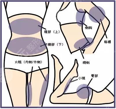 等離子激光溶脂有危害嗎？