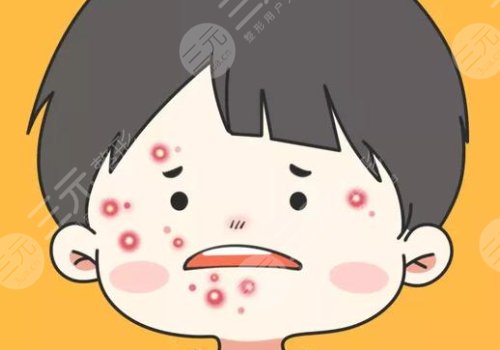 彩光祛痘果怎么樣?