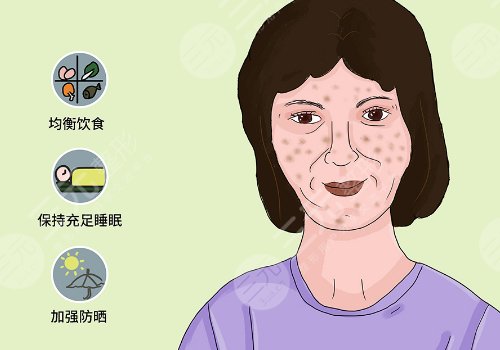 簡單美白祛斑的方法有哪些？