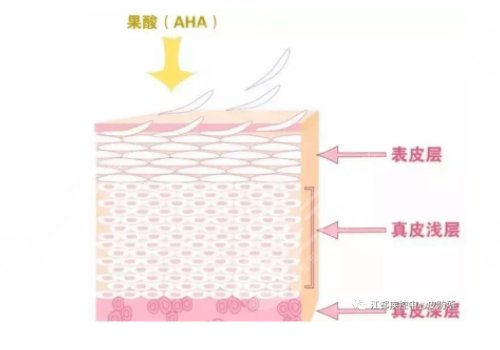 果酸換膚的功有什么?