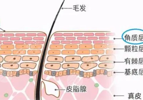 果酸換膚的功有什么?