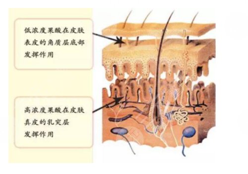 果酸換膚的功有什么?