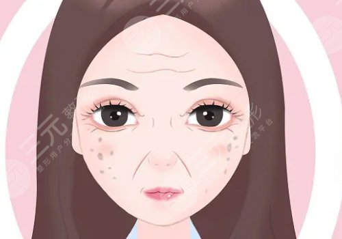 怎樣治老年斑？