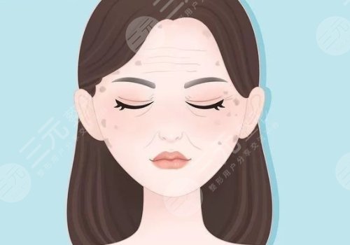 怎樣治老年斑？