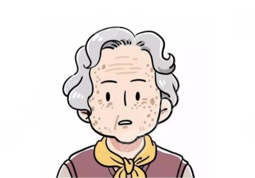 怎樣治老年斑？