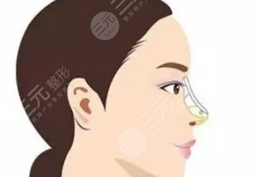 蘭州夢想整形醫(yī)院怎么樣?