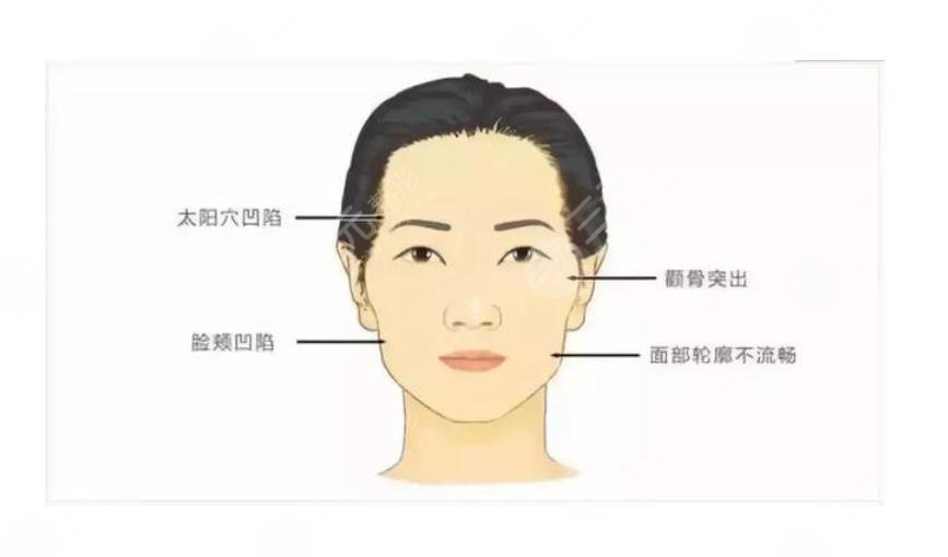 微創(chuàng)改臉型手術(shù)價(jià)?格多少?