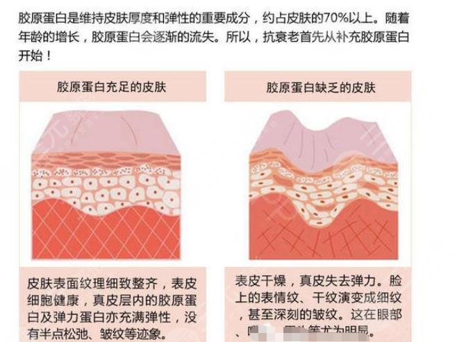 哪種膠原蛋白好?