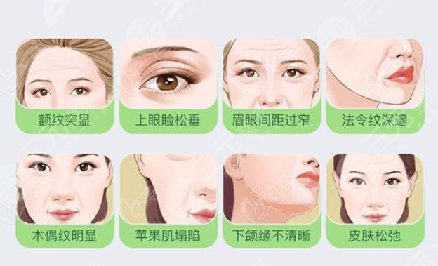 大拉皮除皺手術(shù)后可維持多少年