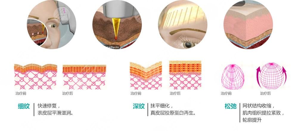 簡單美白祛斑的方法有哪些？