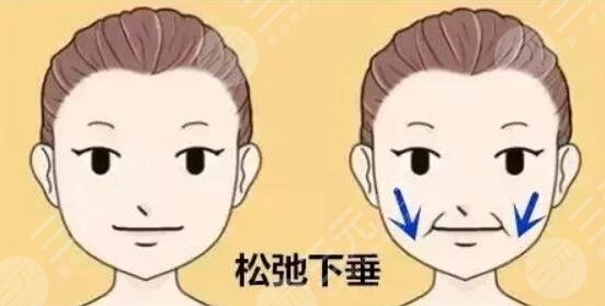 面部下垂提升術(shù)多少錢？具體術(shù)式、操作方案及步驟、預(yù)期果點擊了解！
