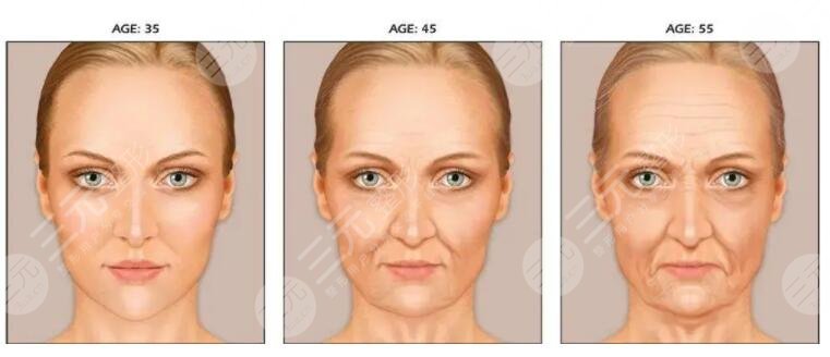 面部下垂提升術(shù)多少錢