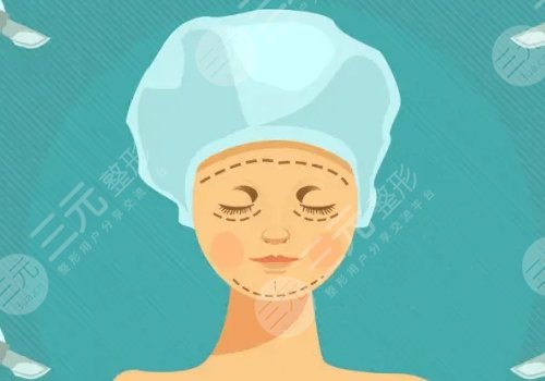 自體脂肪填充下眼瞼凹陷可以維持多久？