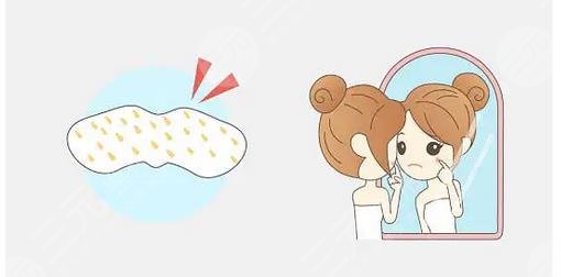 如何去除妊娠斑有??