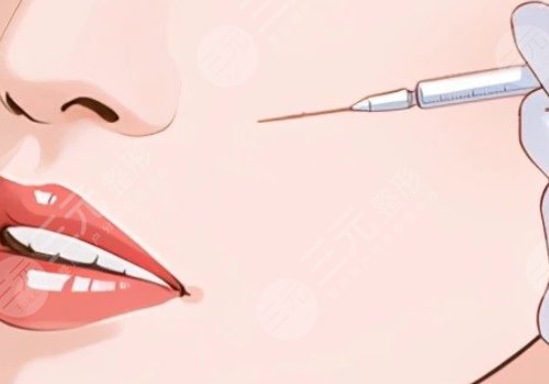 瑞蘭2號玻尿酸適合打哪里?