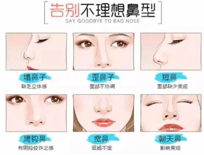 自體軟骨隆鼻是什么原理呢?