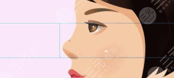 自體軟骨隆鼻好嗎？有什么優(yōu)勢(shì)？手術(shù)注意事項(xiàng)建議要銘記于心！