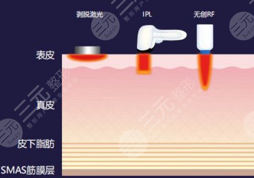 熱瑪吉和超聲炮一起做好還是分開做好
