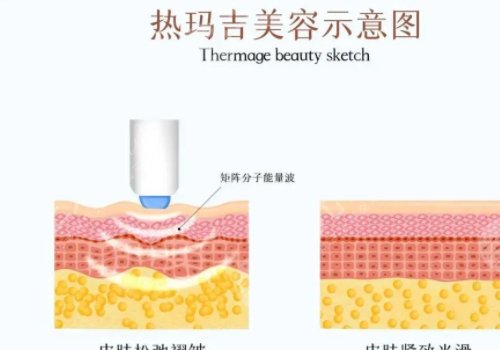 熱瑪吉和超聲炮一起做好還是分開做好