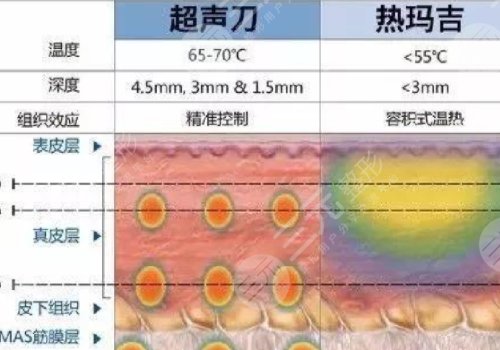 熱瑪吉和超聲炮一起做好還是分開做好