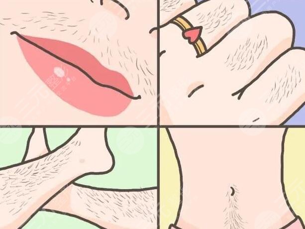 北京全身脫毛的注意事項(xiàng)