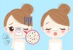 臉毛孔粗大怎么辦？3種方案介紹！2項(xiàng)輕醫(yī)美帶你重拾細(xì)膩美肌~