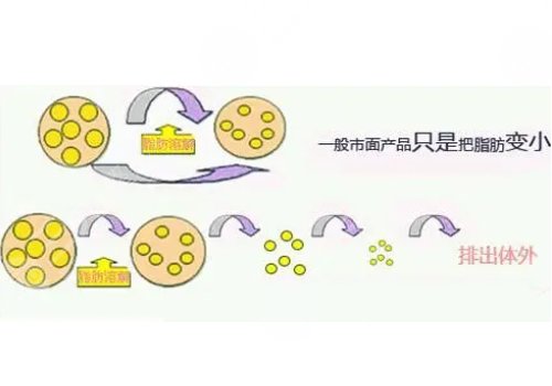 做了鐳射溶脂之后需要注意什么?