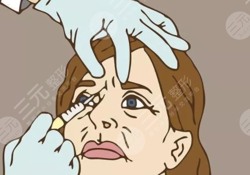 瑞蘭2號玻尿酸多少錢？