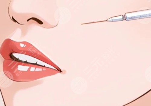 瑞蘭2號玻尿酸多少錢？